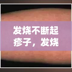 发烧不断起疹子,发烧时起疹子一会又消了