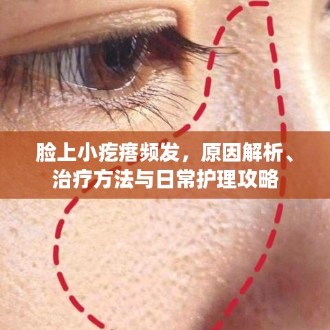 脸上小疙瘩频发，原因解析、治疗方法与日常护理攻略