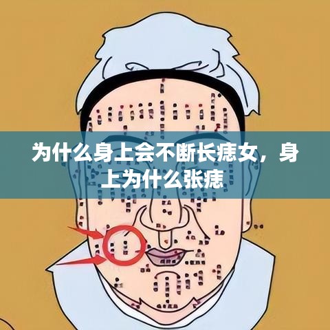 为什么身上会不断长痣女，身上为什么张痣 