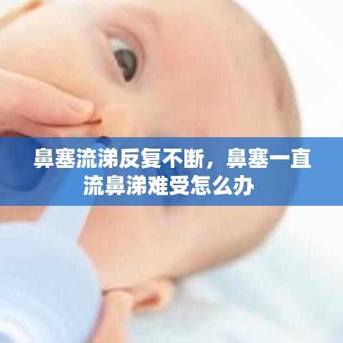 鼻塞流涕反复不断，鼻塞一直流鼻涕难受怎么办 