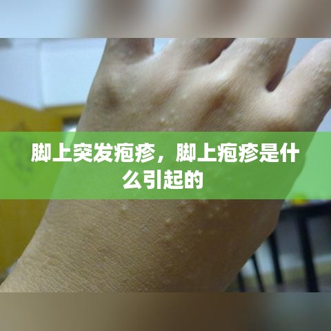 脚上突发疱疹，脚上疱疹是什么引起的 