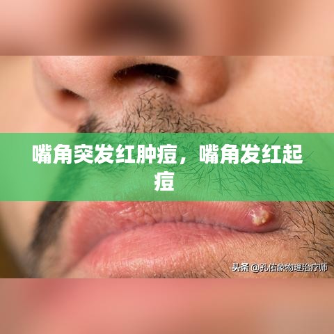嘴角突发红肿痘，嘴角发红起痘 