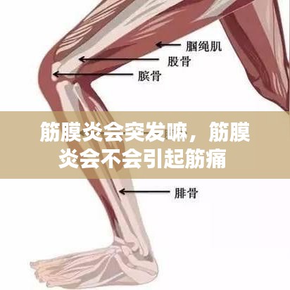 筋膜炎会突发嘛，筋膜炎会不会引起筋痛 