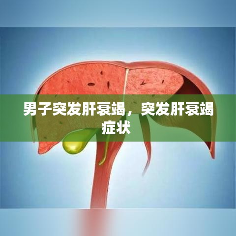 男子突发肝衰竭,突发肝衰竭症状