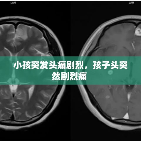 小孩突发头痛剧烈,孩子头突然剧烈痛