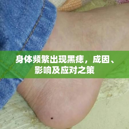 身体频繁出现黑痣，成因、影响及应对之策