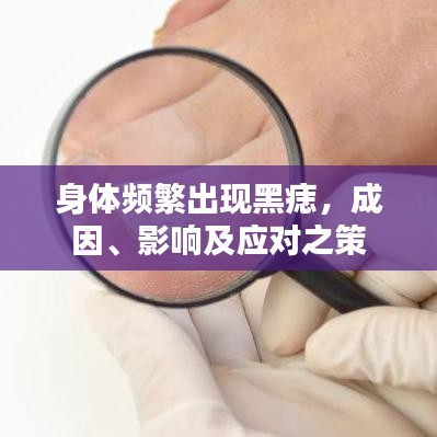身体频繁出现黑痣,成因、影响及应对之策