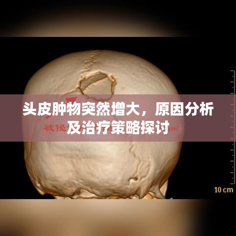 头皮肿物突然增大，原因分析及治疗策略探讨