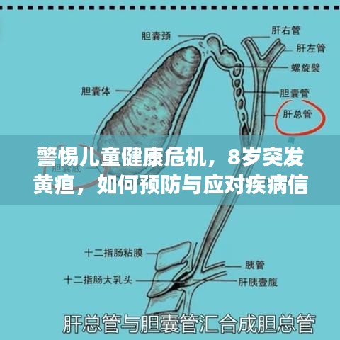 警惕儿童健康危机,8岁突发黄疸,如何预防与应对疾病信号?