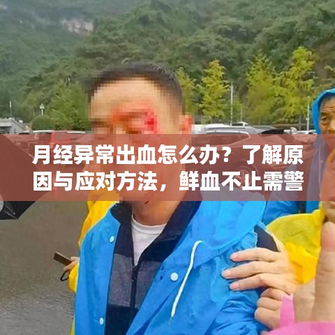 月经异常出血怎么办？了解原因与应对方法，鲜血不止需警惕！