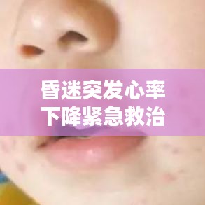 昏迷突发心率下降紧急救治措施与应对策略