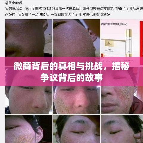 微商背后的真相与挑战,揭秘争议背后的故事